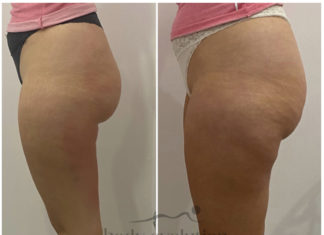 Body Evolution Ursus – To naprawdę działa! body evolution ursus to naprawde dziala