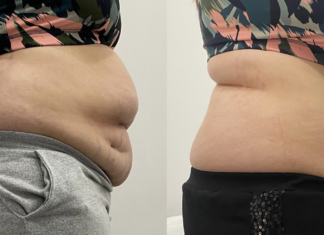 Wielka metamorfoza w Body Evolution Ursus! metamorfoza body evolution ursus